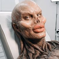 Ibruprofeno