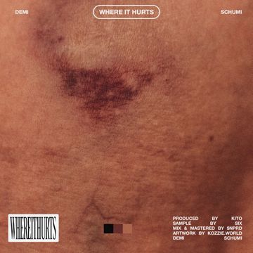 WHEREITHURTS (feat. Schumi)-cover