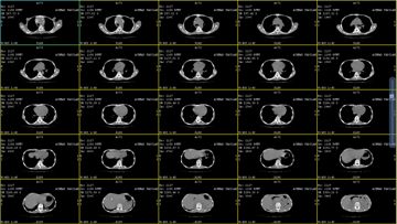 bawa-dia-kembali-velicia-cover-image