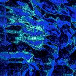 Blue Dreams(Erick T Remix)(Remix)-cover